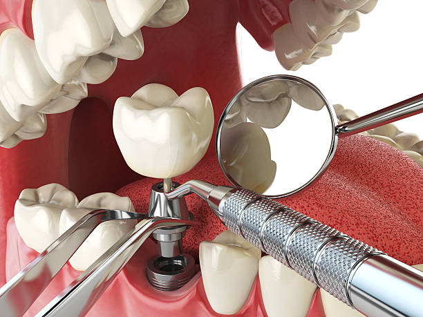 Best Emergency Dental Care for Trauma or Injury in Big Spring, TX
